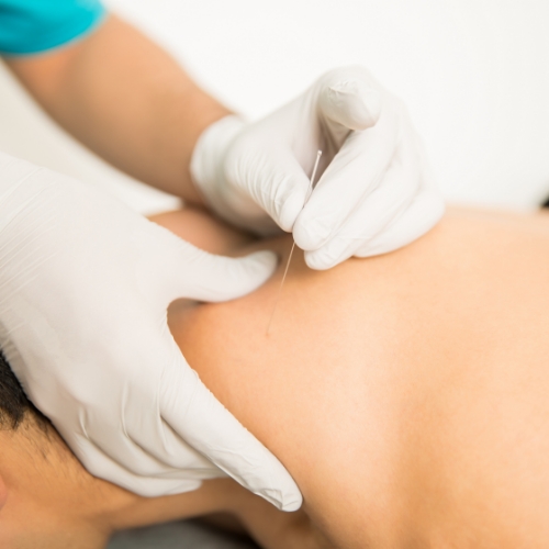physical-therapy-clinic-dry-needling
